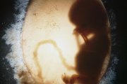 Biología y embarazo en la mujer: bolsa amniótica que contiene un embrión humano (o feto) (silueta) en la undécima semana de fecundación. Imagen médica (ecografía)