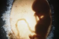 Biología y embarazo en la mujer: bolsa amniótica que contiene un embrión humano (o feto) (silueta) en la undécima semana de fecundación. Imagen médica (ecografía)