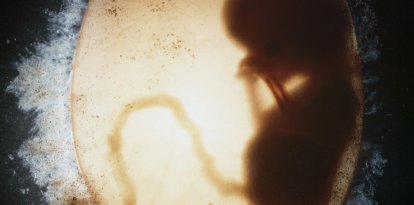 Biología y embarazo en la mujer: bolsa amniótica que contiene un embrión humano (o feto) (silueta) en la undécima semana de fecundación. Imagen médica (ecografía)