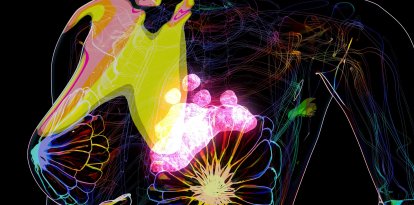Una ilustración conceptual de cáncer de mama (Archivo)