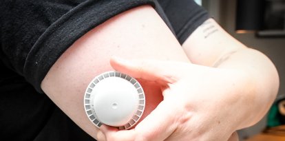 La imagen muestra el aplicador del sensor de glucosa en el brazo de un paciente (Archivo)