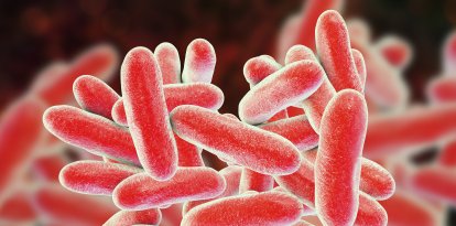 legionella