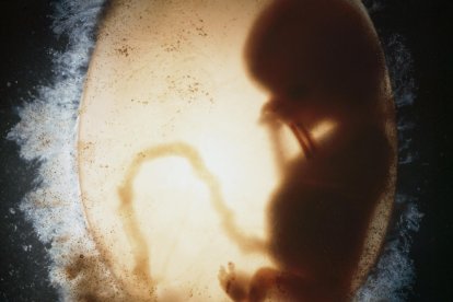 Biología y embarazo en la mujer: bolsa amniótica que contiene un embrión humano (o feto) (silueta) en la undécima semana de fecundación. Imagen médica (ecografía)