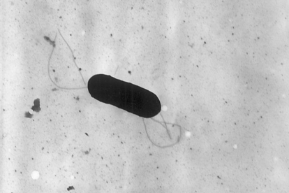 Micrografía electrónica de una bacteria Listeria monocytogenes
