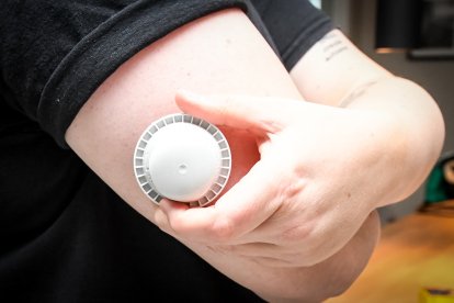 La imagen muestra el aplicador del sensor de glucosa en el brazo de un paciente (Archivo)