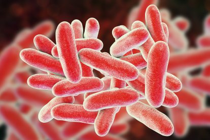 legionella