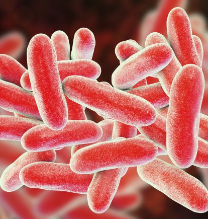 legionella