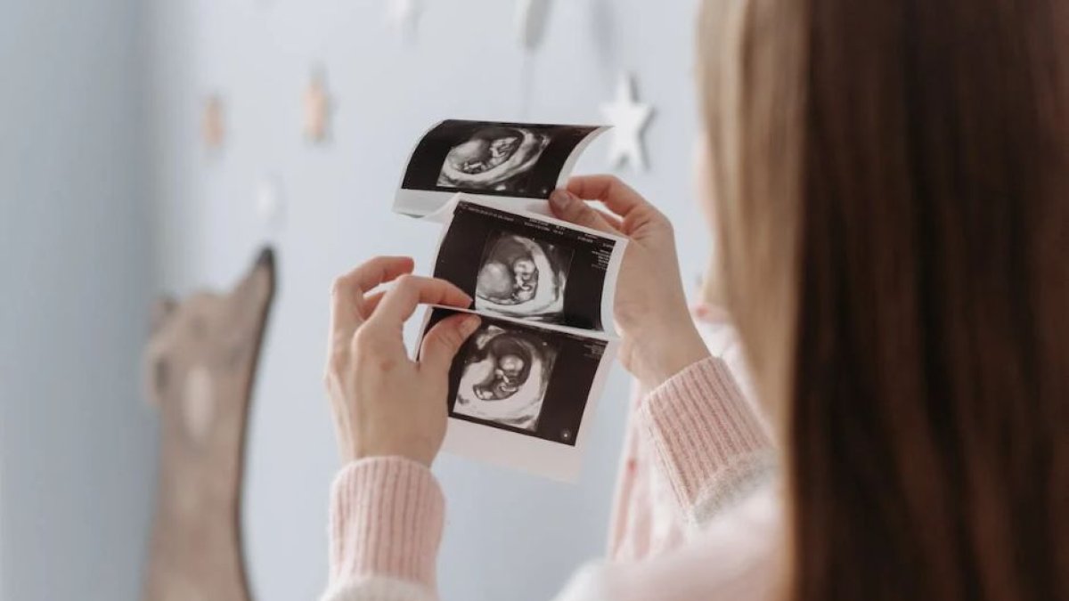 Un mujer mira ecografías de su embarazo.