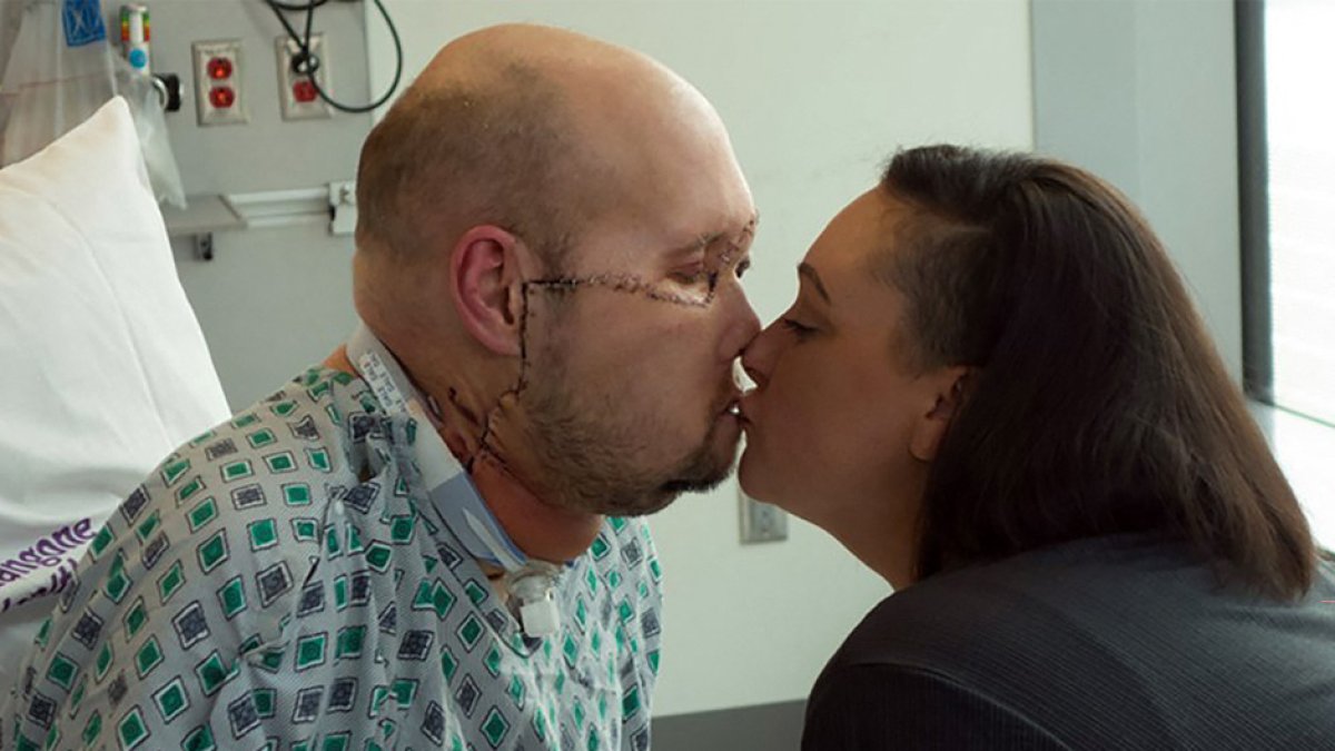 In this undated image released by NYU Langone Health, Aaron James (L) kisses his wife Meagan while he recovers from the first whole-eye and partial face transplant, at NY Langone Health in New York. A team of surgeons in New York has performed the world's first transplant of an entire eye in a procedure described as a medical breakthrough, though it isn't yet known whether the patient will regain their sight. The groundbreaking surgery involved removing part of the face and the whole left eye of a donor and grafting them onto James, a 46-year-old lineworker who survived a 7,200-volt electric shock in June 2021 when his face touched a live wire. (Photo by Handout / NYU Langone Health / AFP)