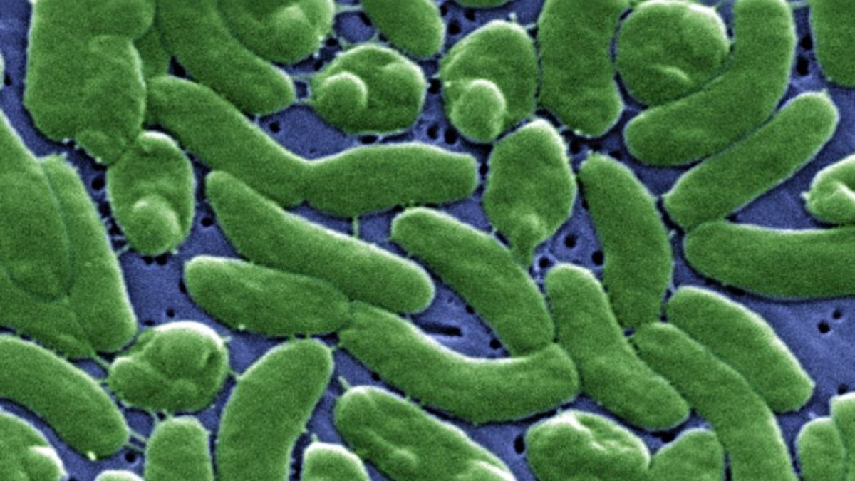 Imagen telescópica de 'Vibrio vulnificus', la nueva bacteria carnívora que está afectando en los Estados Unidos.