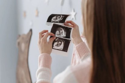 A woman looks at ecographs of her pregnancy.