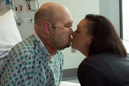 In this undated image released by NYU Langone Health, Aaron James (L) kisses his wife Meagan while he recovers from the first whole-eye and partial face transplante, at NY Langone Health in New York. A team of surgeons in New York has performed the world's first transplant of an entire eye in a procedure described as a medical breakthrough, though it isn't yet known whether the patient will regain their sight. The groundbreaking surgery involved removing part of the face and the whole left eye of a donor and grafting them onto James, a 46-year-old lineworker who survived a 7,200-volt electric shock in June 2021 when his face touched a live wire. (Photo by Handout / NYU Langone Health / AFP)