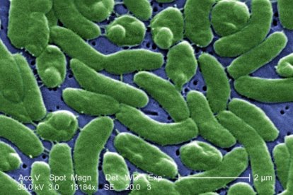 Imagen telescópica de 'Vibrio vulnificus', la nueva bacteria carnívora que está afectando en los Estados Unidos.