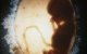 Biología y embarazo en la mujer: bolsa amniótica que contiene un embrión humano (o feto) (silueta) en la undécima semana de fecundación. Imagen médica (ecografía)