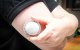 La imagen muestra el aplicador del sensor de glucosa en el brazo de un paciente (Archivo)