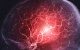 Ictus, imagen conceptual. Angiografía (radiografía de vasos sanguíneos) de las arterias cerebrales. (Archivo)