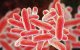 legionella