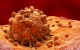 Imagen de un Melanoma, en visión microscópica