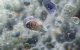 Imagen de Naegleria fowleri