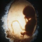 Biología y embarazo en la mujer: bolsa amniótica que contiene un embrión humano (o feto) (silueta) en la undécima semana de fecundación. Imagen médica (ecografía)