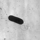 Micrografía electrónica de una bacteria Listeria monocytogenes