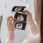 Aumenta la natalidad en los estados que vetan el aborto: 32.000 nacimientos más en los primeros seis meses de 2023