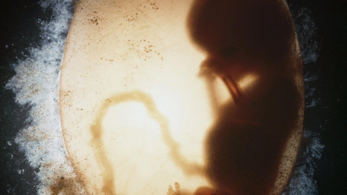 Image of an ultrasound of an 11-week-old fetus