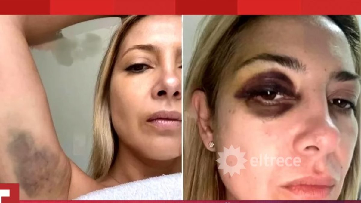 Imágenes de la denuncia de Yañez contra Fernández