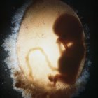 Biología y embarazo en la mujer: bolsa amniótica que contiene un embrión humano (o feto) (silueta) en la undécima semana de fecundación. Imagen médica (ecografía)